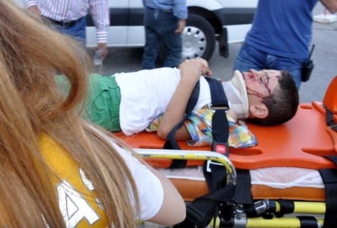 Sivas`ta Trafik Kazası: 4 Yaralı